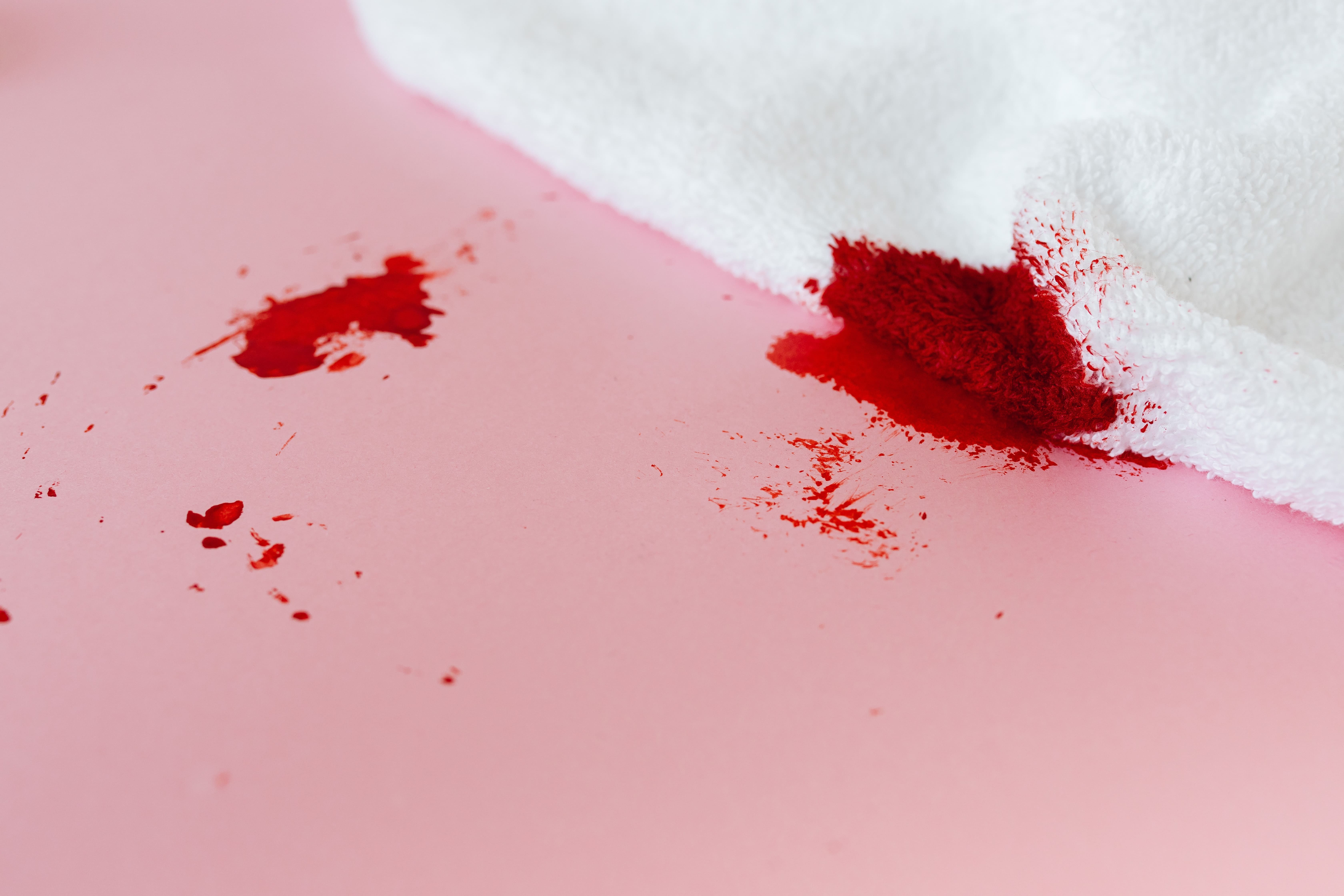 Tache de sang : comment la nettoyer et l'enlever naturellement ?